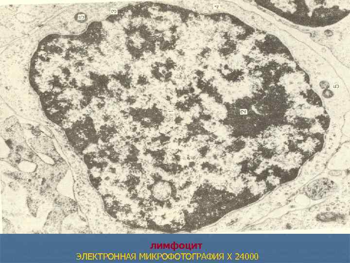 лимфоцит ЭЛЕКТРОННАЯ МИКРОФОТОГРАФИЯ X 24000 