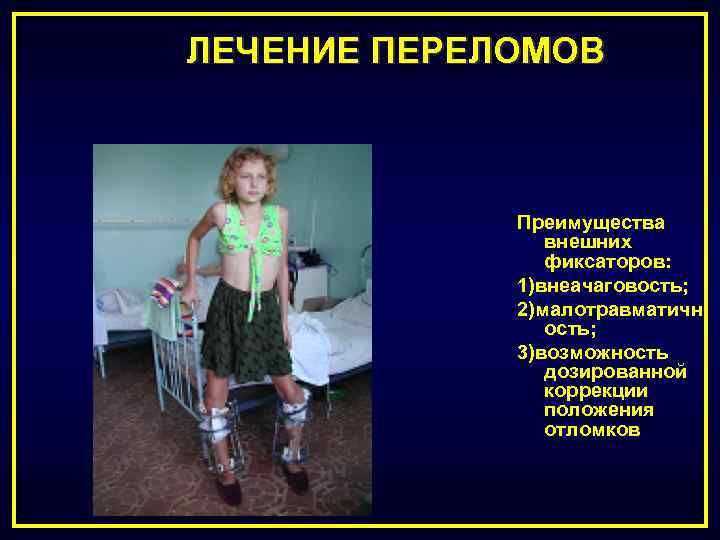 ЛЕЧЕНИЕ ПЕРЕЛОМОВ Преимущества внешних фиксаторов: 1)внеачаговость; 2)малотравматичн ость; 3)возможность дозированной коррекции положения отломков 