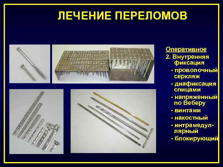 ЛЕЧЕНИЕ ПЕРЕЛОМОВ Оперативное 2. Внутренняя фиксация - проволочный серкляж - диафиксация спицами - напряженный