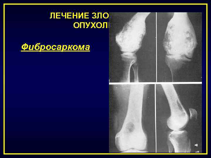 Национальное руководство по лекарственному лечению злокачественных опухолей