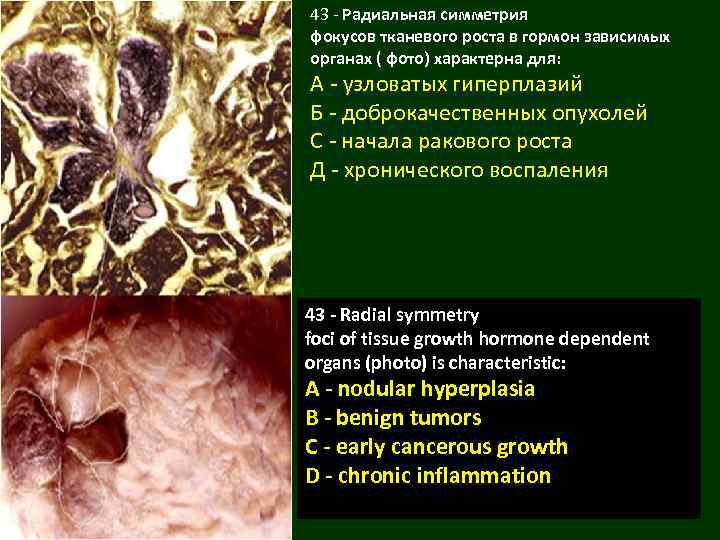 43 - Радиальная симметрия фокусов тканевого роста в гормон зависимых органах ( фото) характерна