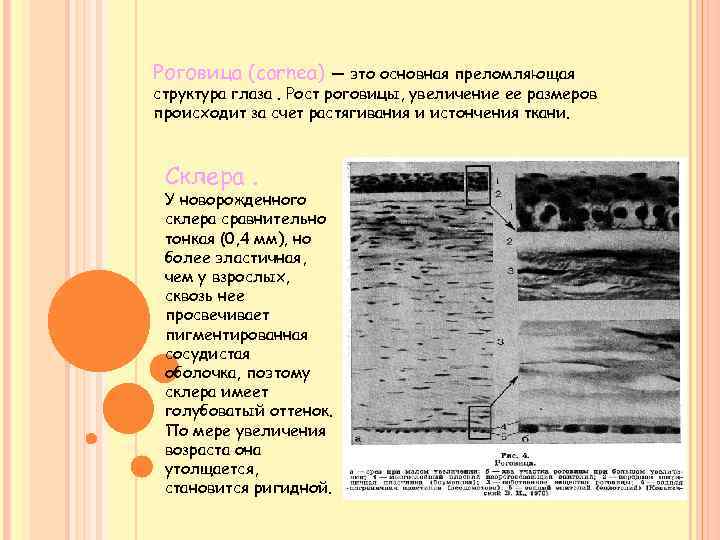 Роговица (cornea) — это основная преломляющая структура глаза. Рост роговицы, увеличение ее размеров происходит