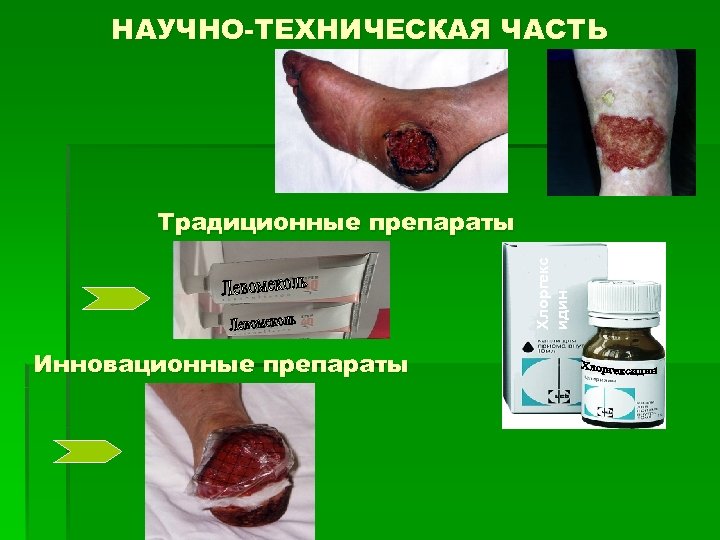 НАУЧНО-ТЕХНИЧЕСКАЯ ЧАСТЬ Хлоргекс идин Традиционные препараты Инновационные препараты 