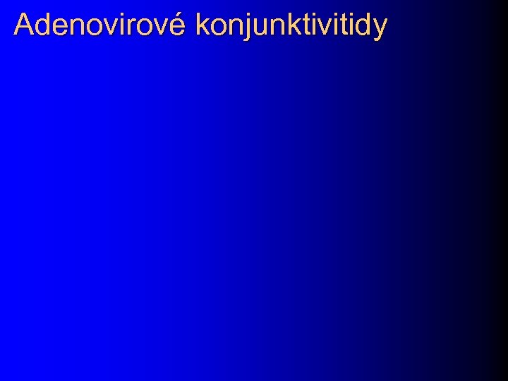 Adenovirové konjunktivitidy 