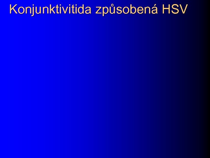 Konjunktivitida způsobená HSV 