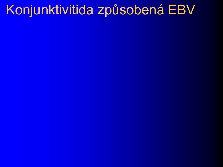 Konjunktivitida způsobená EBV 