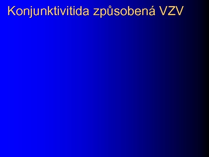 Konjunktivitida způsobená VZV 