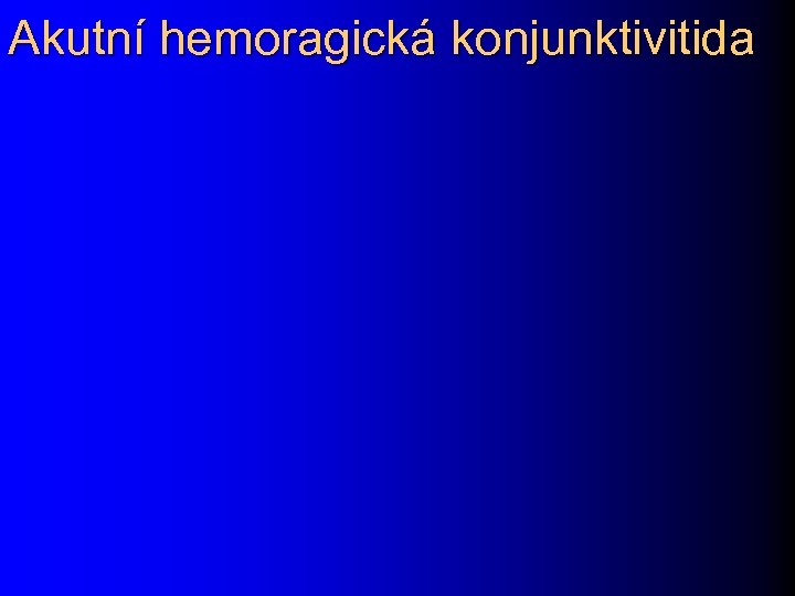 Akutní hemoragická konjunktivitida 