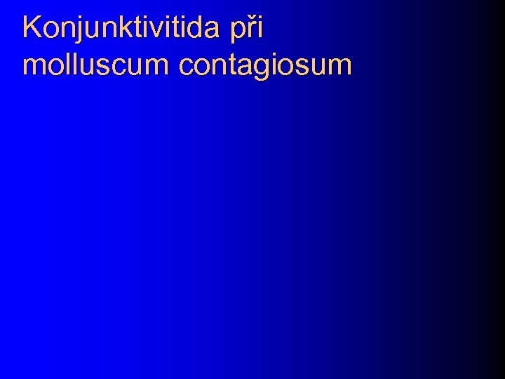 Konjunktivitida při molluscum contagiosum 