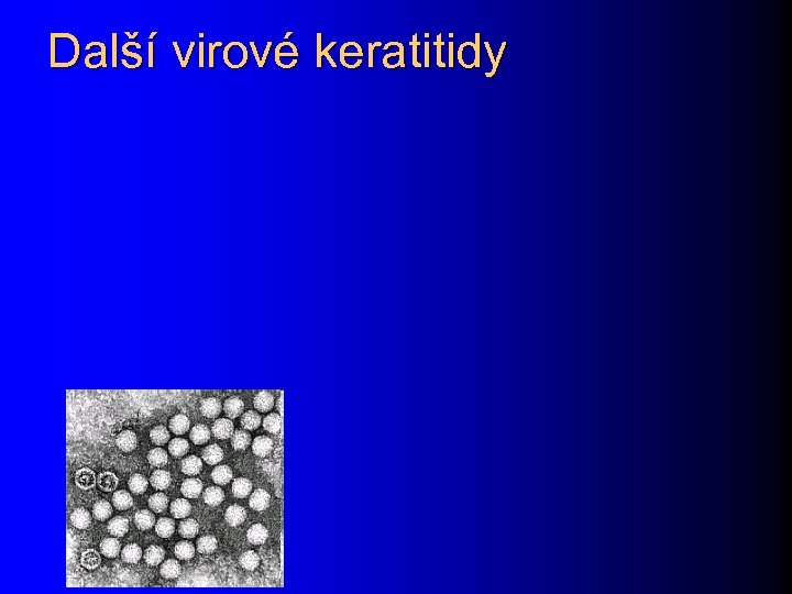 Další virové keratitidy 