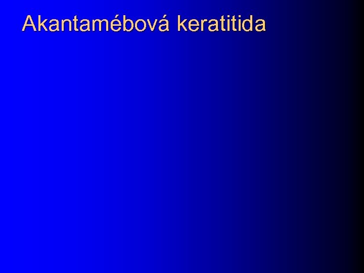 Akantamébová keratitida 