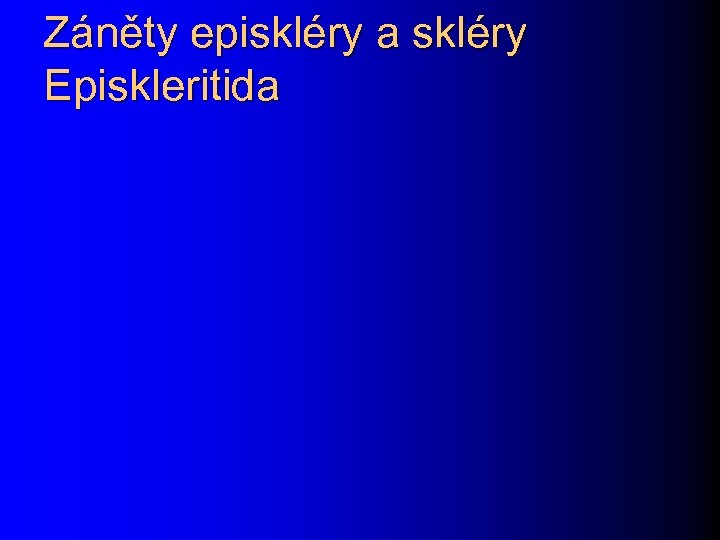 Záněty episkléry a skléry Episkleritida 