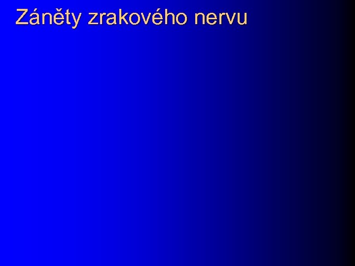 Záněty zrakového nervu 