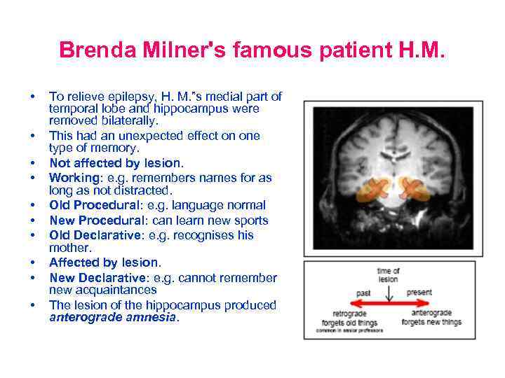Brenda Milner's famous patient H. M. • • • To relieve epilepsy, H. M.