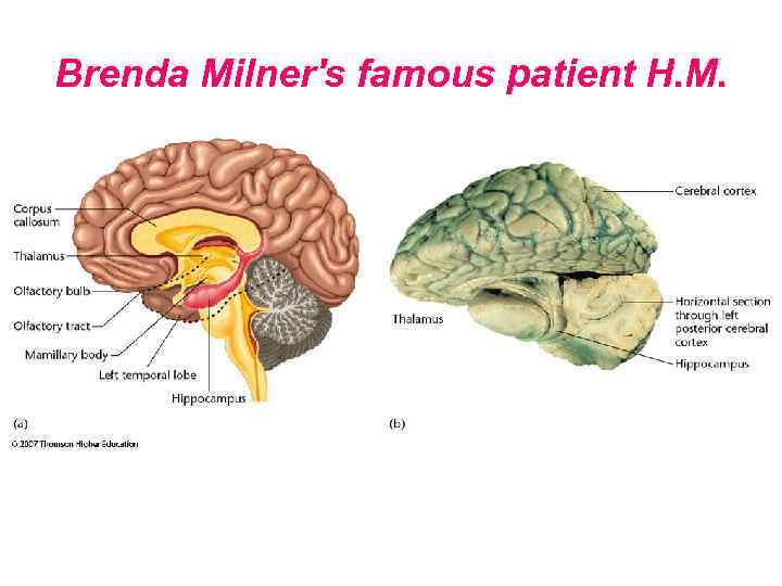 Brenda Milner's famous patient H. M. 