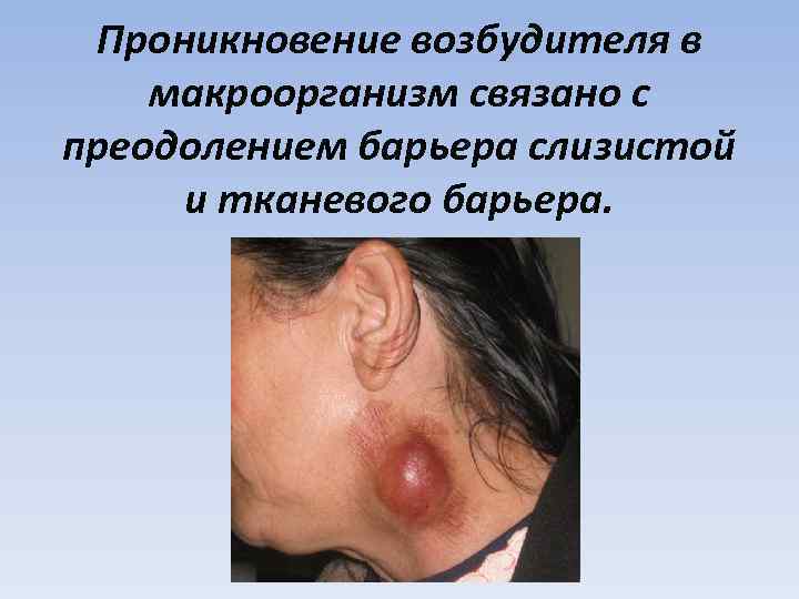 Проникновение возбудителя в макроорганизм связано с преодолением барьера слизистой и тканевого барьера. 