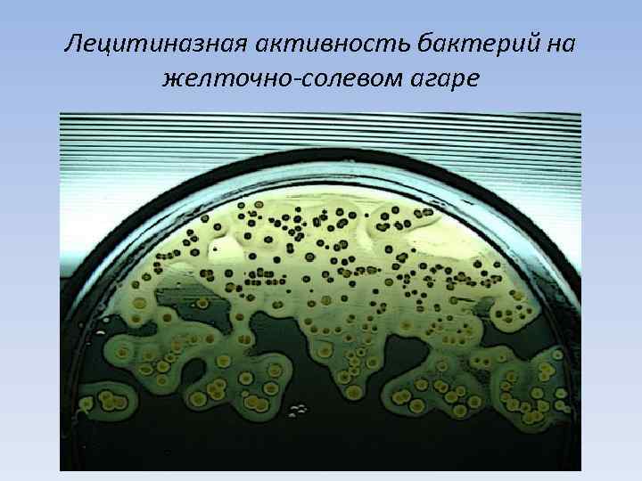 Лецитиназная активность бактерий на желточно-солевом агаре 