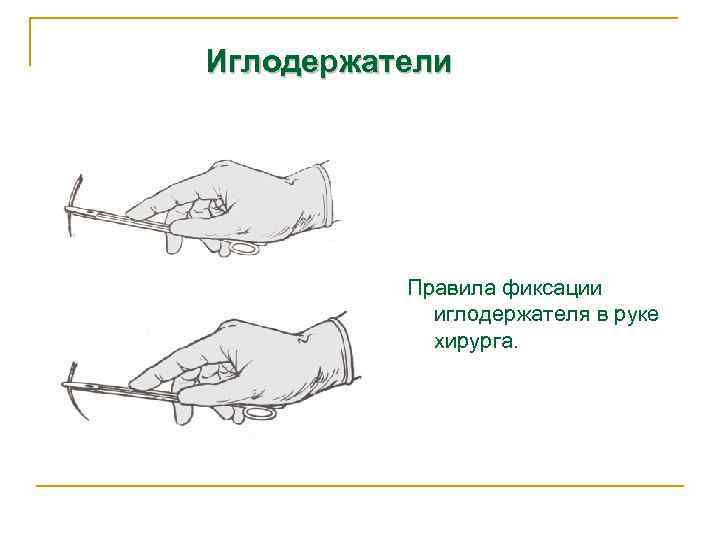 Иглодержатели Правила фиксации иглодержателя в руке хирурга. 