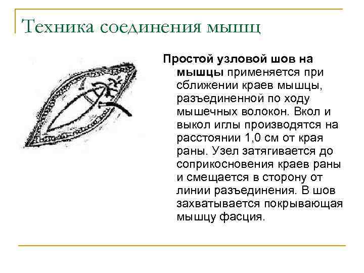 Техника соединения мышц Простой узловой шов на мышцы применяется при сближении краев мышцы, разъединенной