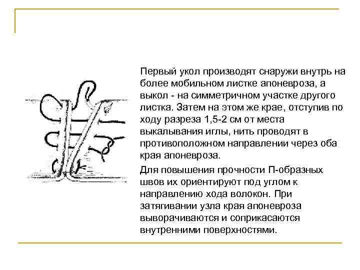 Первый укол производят снаружи внутрь на более мобильном листке апоневроза, а выкол - на