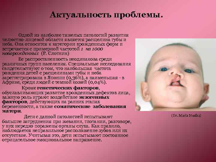 Актуальность проблемы. Одной из наиболее тяжелых патологий развития челюстно-лицевой области является расщелина губы и