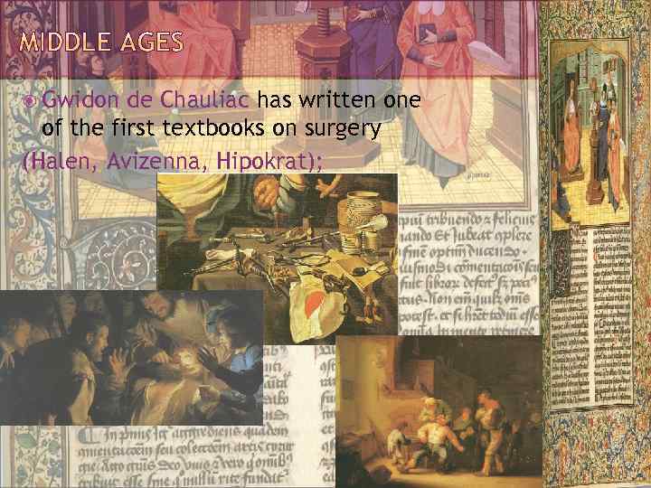  Gwidon de Chauliac has written one of the first textbooks on surgery (Halen,