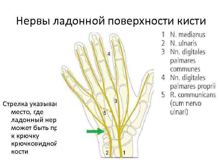 Нервы ладонной поверхности кисти Стрелка указывает место, где ладонный нерв может быть прижат к