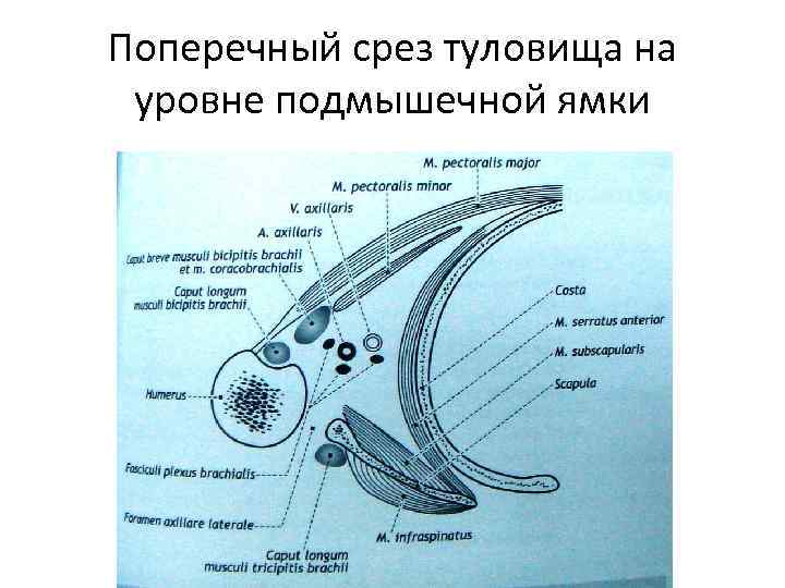 Поперечный срез туловища на уровне подмышечной ямки 