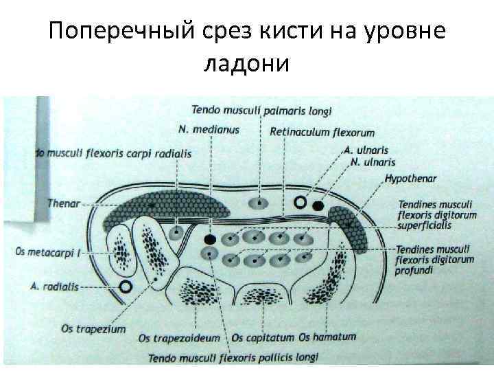 Поперечный срез кисти на уровне ладони 