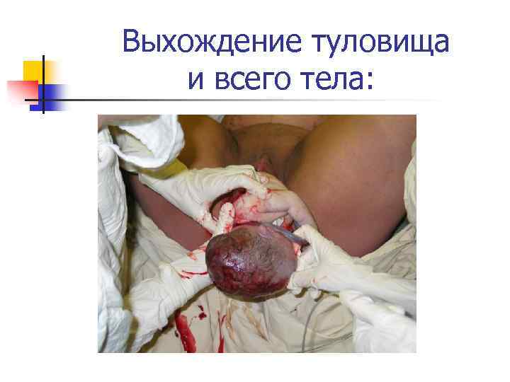 Выхождение туловища и всего тела: 