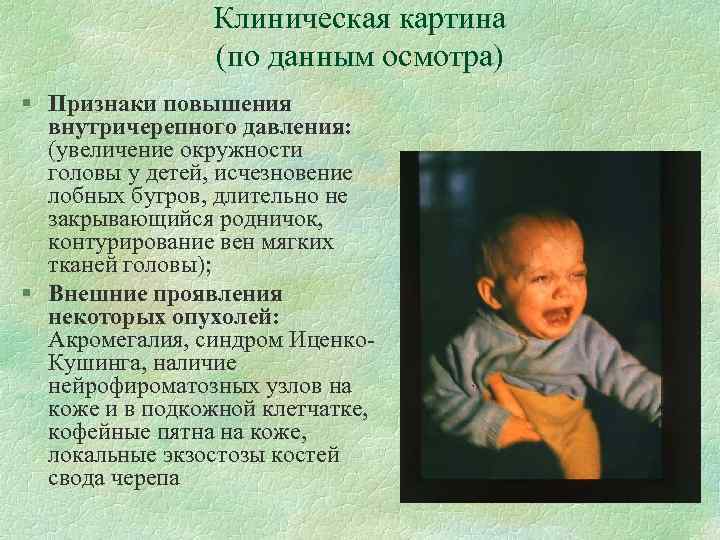 Клиническая картина (по данным осмотра) § Признаки повышения внутричерепного давления: (увеличение окружности головы у