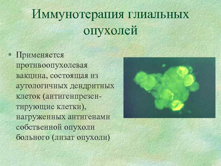 Иммунотерапия глиальных опухолей § Применяется противоопухолевая вакцина, состоящая из аутологичных дендритных клеток (антигенпрезентирующие клетки),