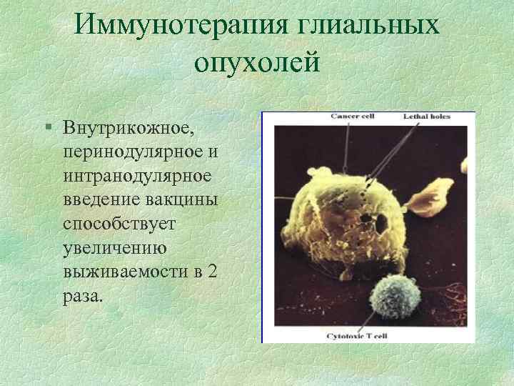 Иммунотерапия глиальных опухолей § Внутрикожное, перинодулярное и интранодулярное введение вакцины способствует увеличению выживаемости в