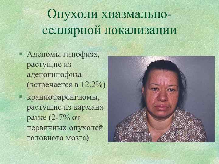 Опухоли хиазмальноселлярной локализации § Аденомы гипофиза, растущие из аденогипофиза (встречается в 12. 2%) §