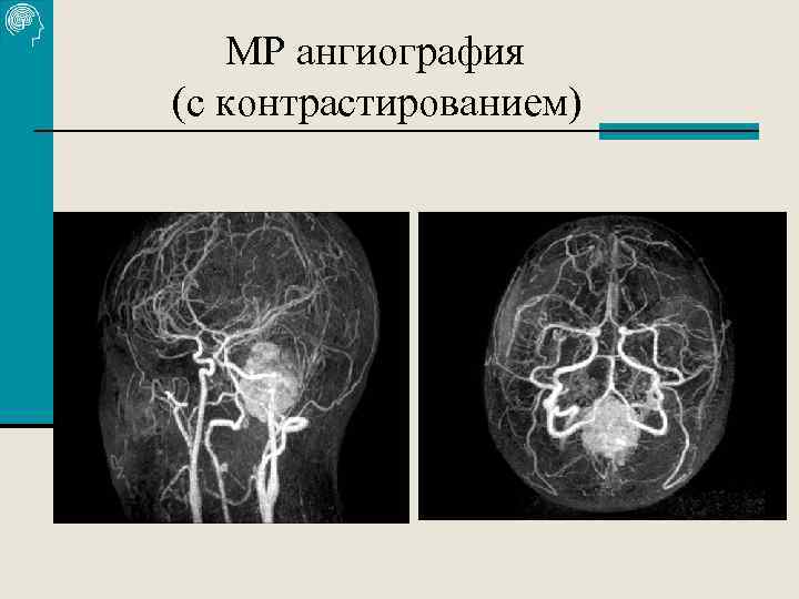 МР ангиография (с контрастированием) 