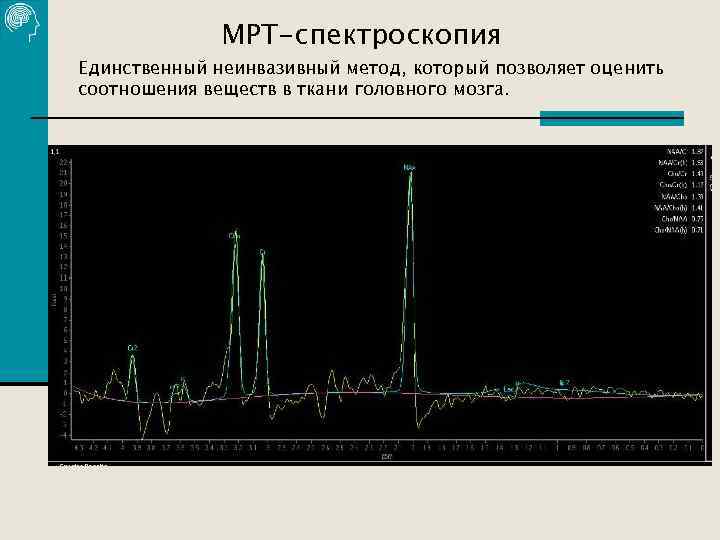 МРТ-спектроскопия Единственный неинвазивный метод, который позволяет оценить соотношения веществ в ткани головного мозга. 