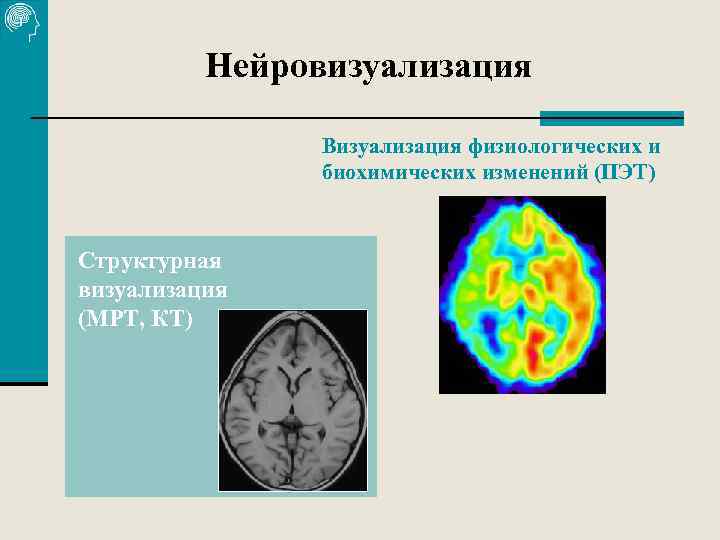 Нейровизуализация Визуализация физиологических и биохимических изменений (ПЭТ) Структурная визуализация (МРТ, КТ) 