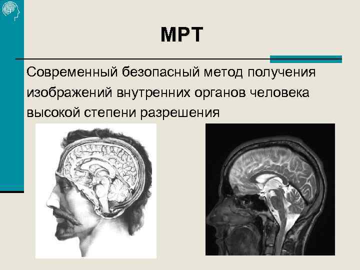 МРТ Современный безопасный метод получения изображений внутренних органов человека высокой степени разрешения 