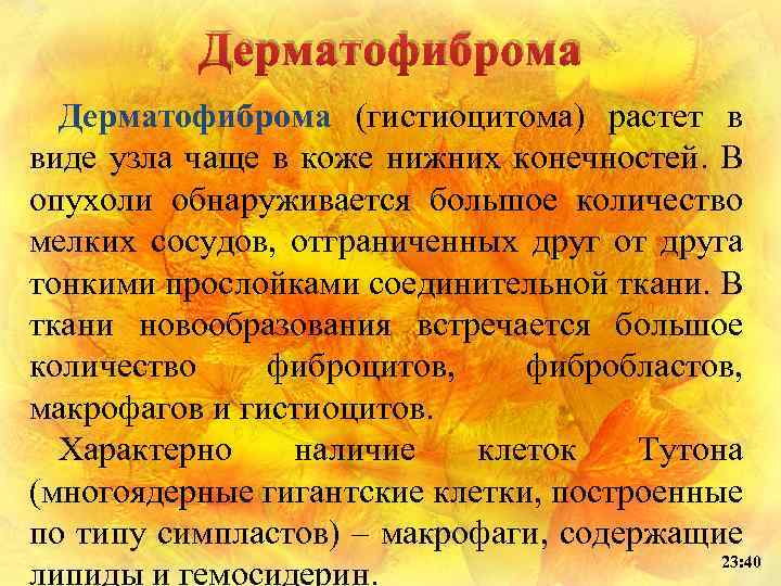 Дерматофиброма (гистиоцитома) растет в виде узла чаще в коже нижних конечностей. В опухоли обнаруживается
