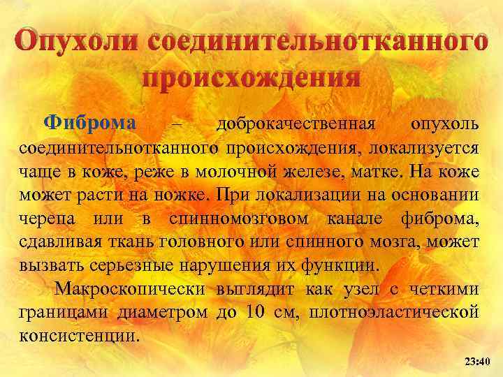 Опухоли соединительнотканного происхождения Фиброма – доброкачественная опухоль соединительнотканного происхождения, локализуется чаще в коже, реже