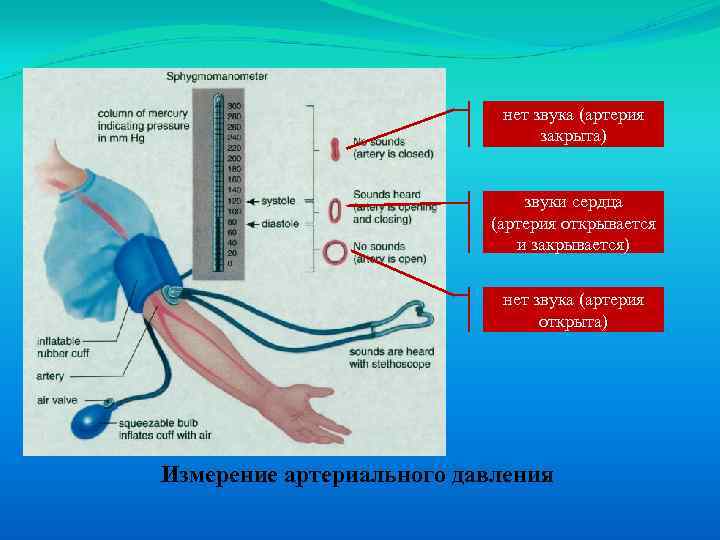нет звука (артерия закрыта) звуки сердца (артерия открывается и закрывается) нет звука (артерия открыта)