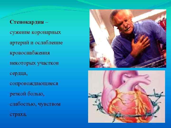 Стенокардия – сужение коронарных артерий и ослабление кровоснабжения некоторых участков сердца, сопровождающиеся резкой болью,