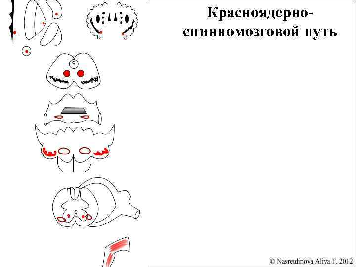 Красноядерноспинномозговой путь 