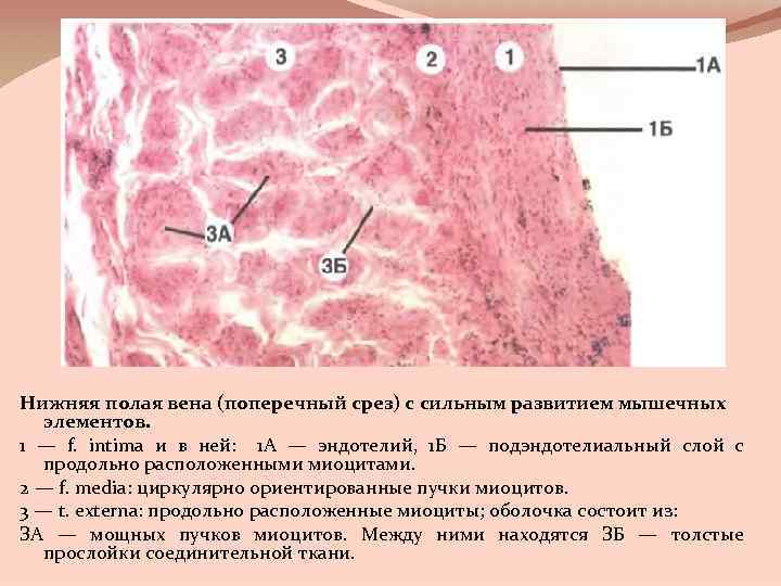 Нижняя полая вена (поперечный срез) с сильным развитием мышечных элементов. 1 — f. intima