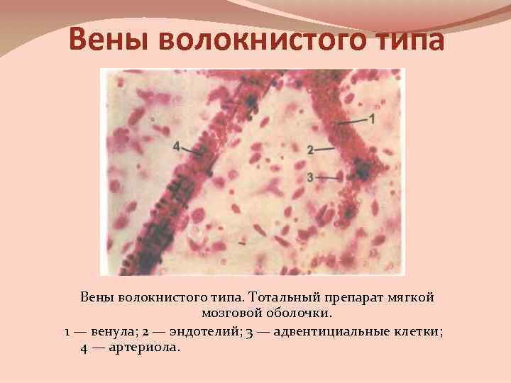 Вены волокнистого типа. Тотальный препарат мягкой мозговой оболочки. 1 — венула; 2 — эндотелий;