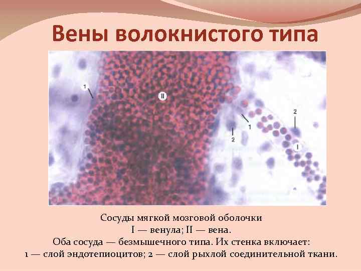 Вены волокнистого типа Сосуды мягкой мозговой оболочки I — венула; II — вена. Оба