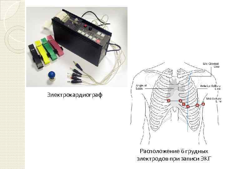 Электрокардиограф Расположение 6 грудных электродов при записи ЭКГ 