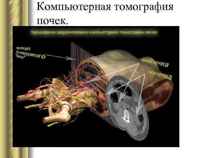 Реконструкция изображений в компьютерной томографии