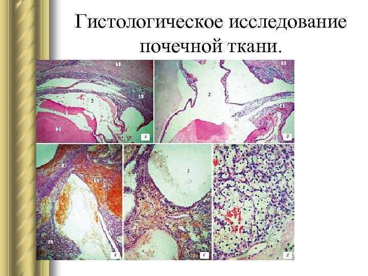 Гистологическое исследование почечной ткани. 