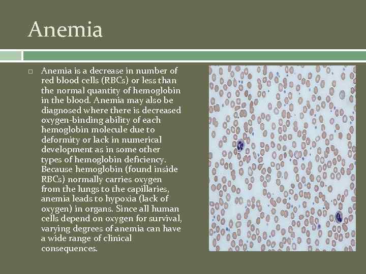 Anemia is a decrease in number of red blood cells (RBCs) or less than